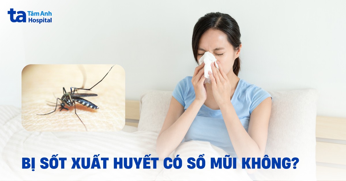 Sot Xuat Huyet Co So Mui Khong