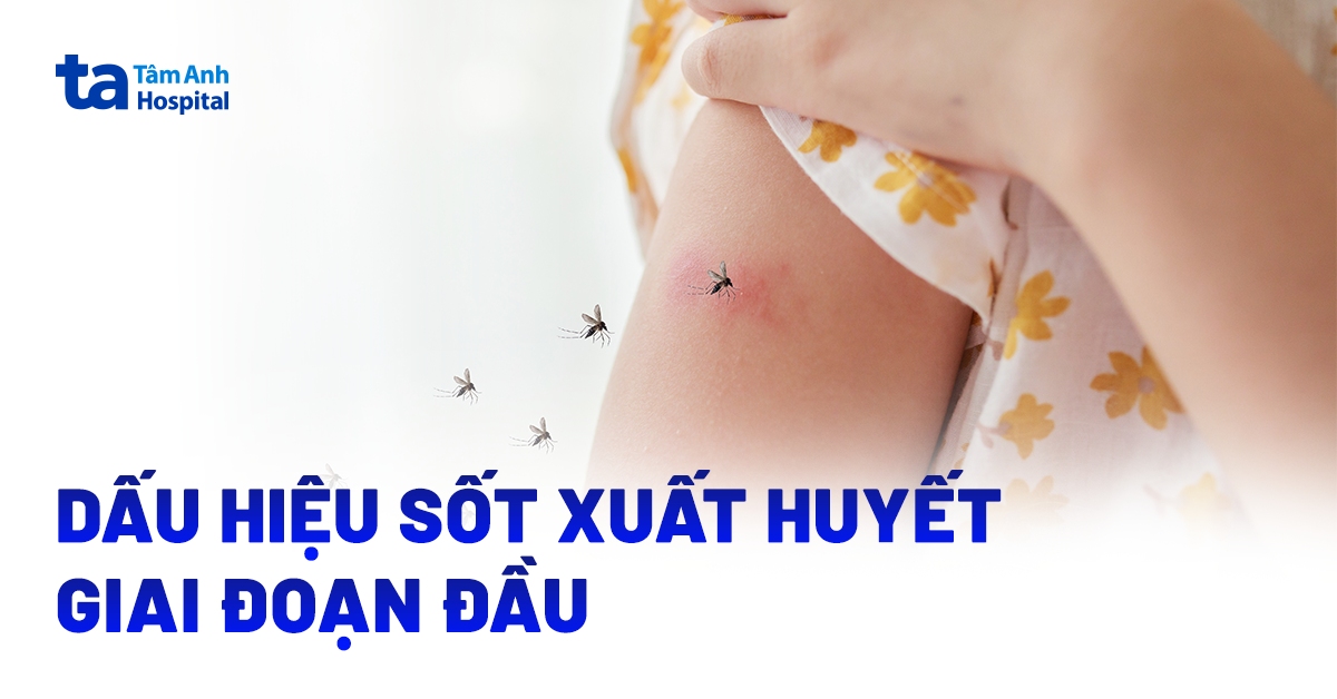 Sốt Xuất Huyết Giai Đoạn Đầu (Giai Đoạn 1): Nhận Biết Thế Nào? Sot Xuat Huyet Giai Doan Dau