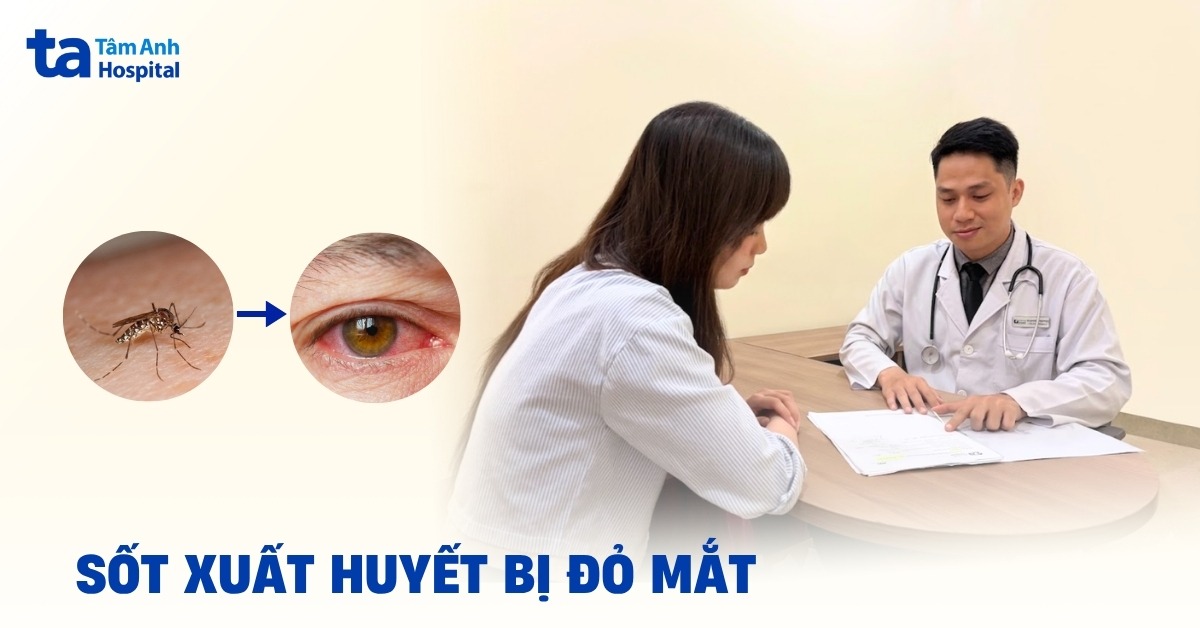Sot Xuat Huyet Mat Do
