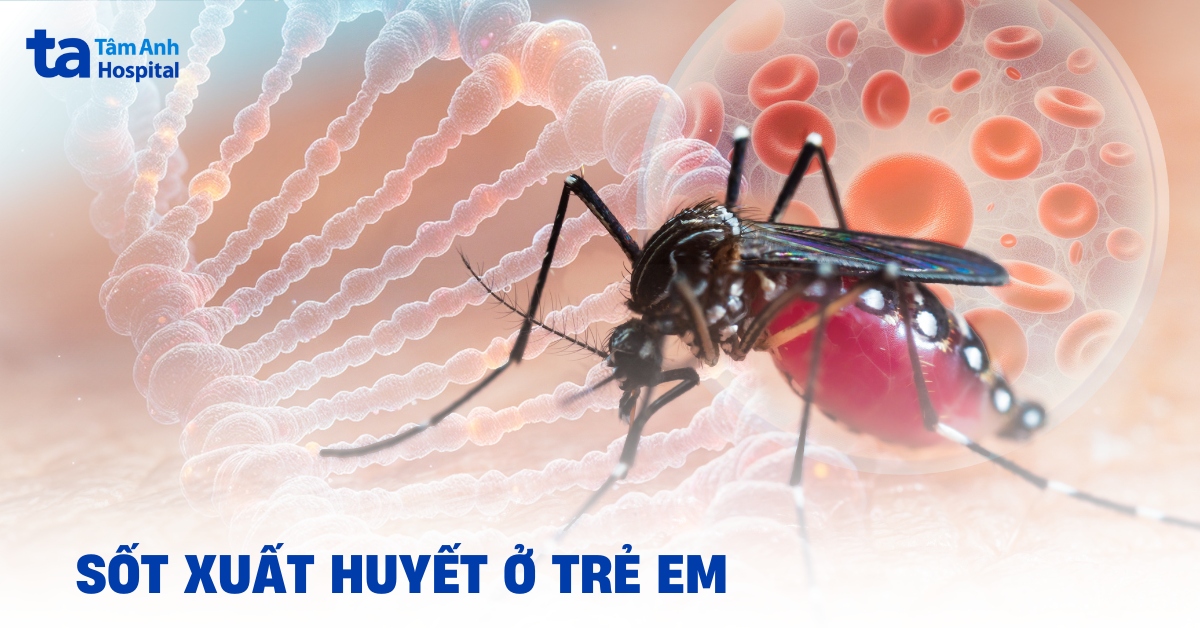 Sot Xuat Huyet O Tre Em