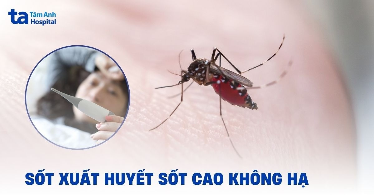 Sot Xuat Huyet Sot Cao Khong Ha