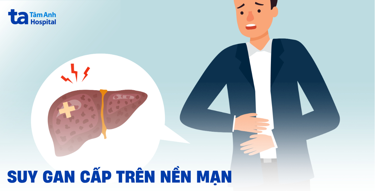 Suy Gan Cap Tren Nen Man