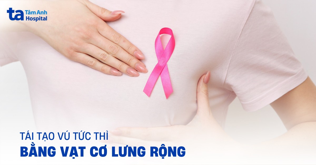 Tai Tao Vu Tuc Thi Bang Vat Co Lung Rong