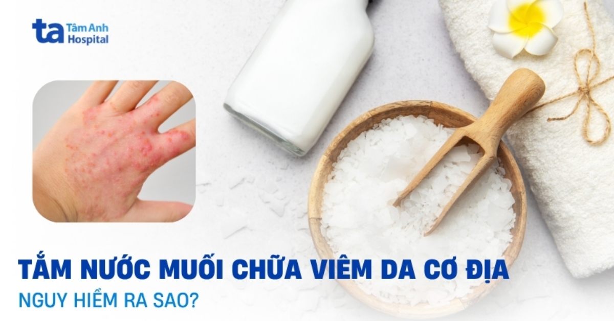 Tam Nuoc Muoi Chua Viem Da Co Dia