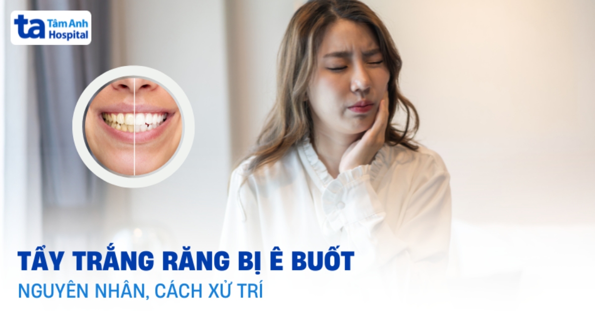 Tay Trang Rang Bi E Buot