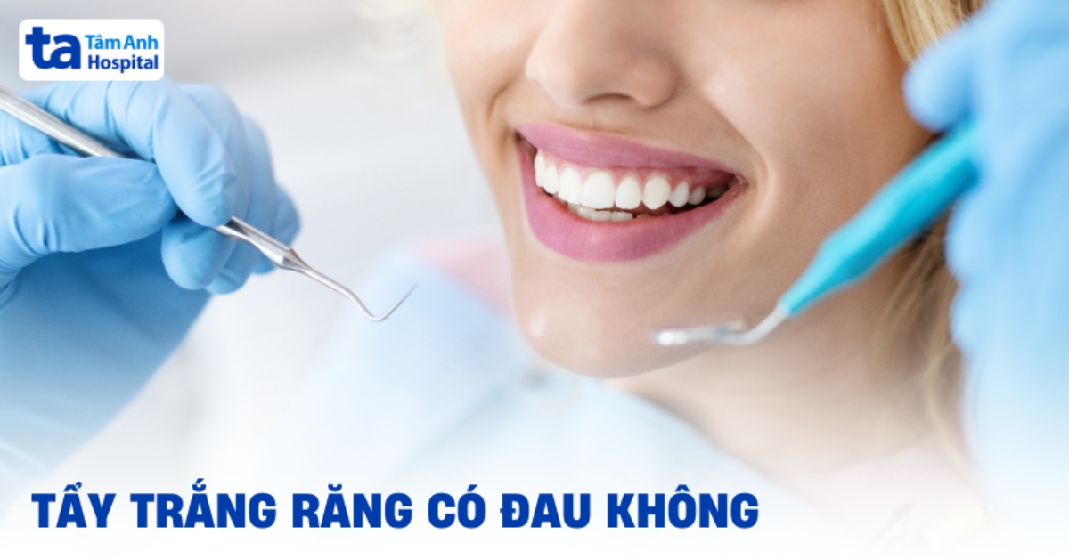 Tay Trang Rang Co Dau Khong