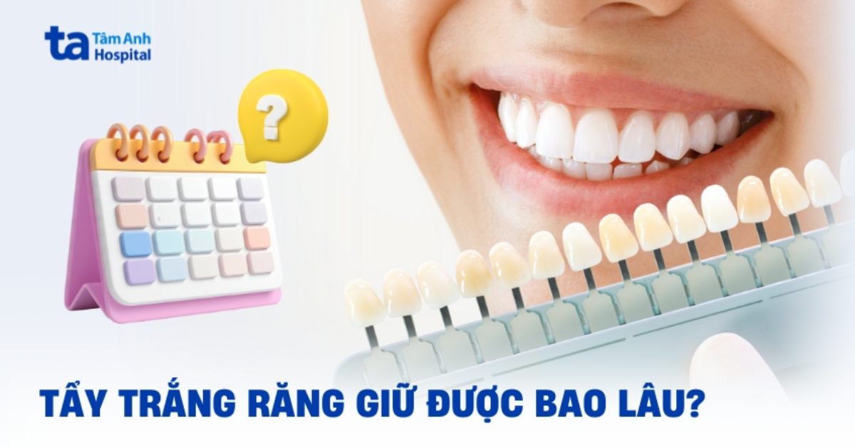 Tay Trang Rang Giu Duoc Bao Lau