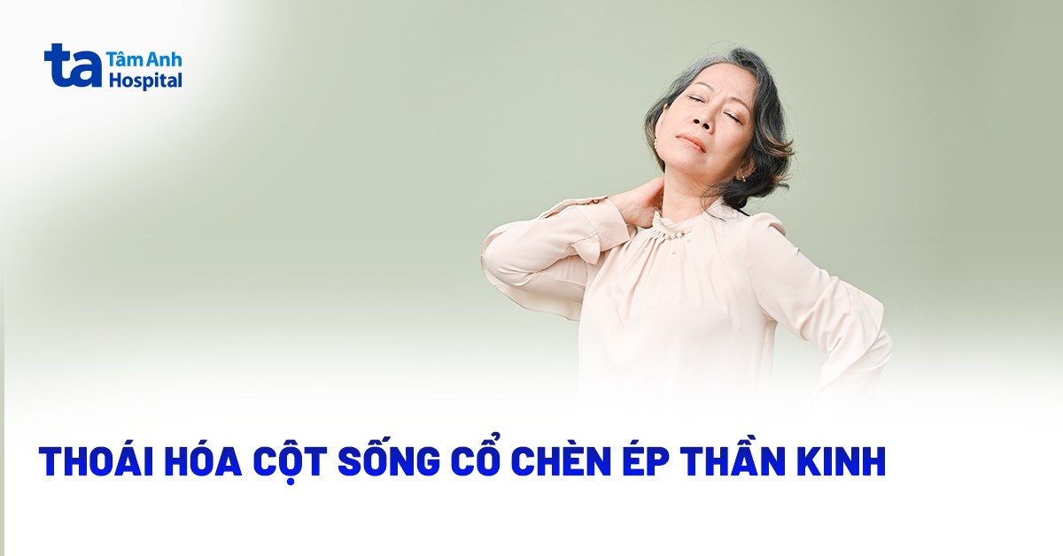 Thoai Hoa Cot Song Co Chen Ep Than Kinh