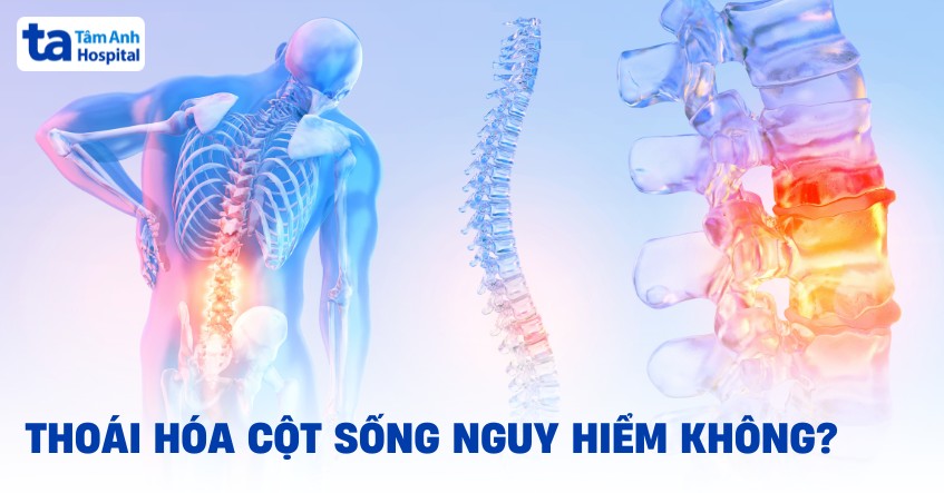Thoai Hoa Cot Song Co Nguy Hiem Khong