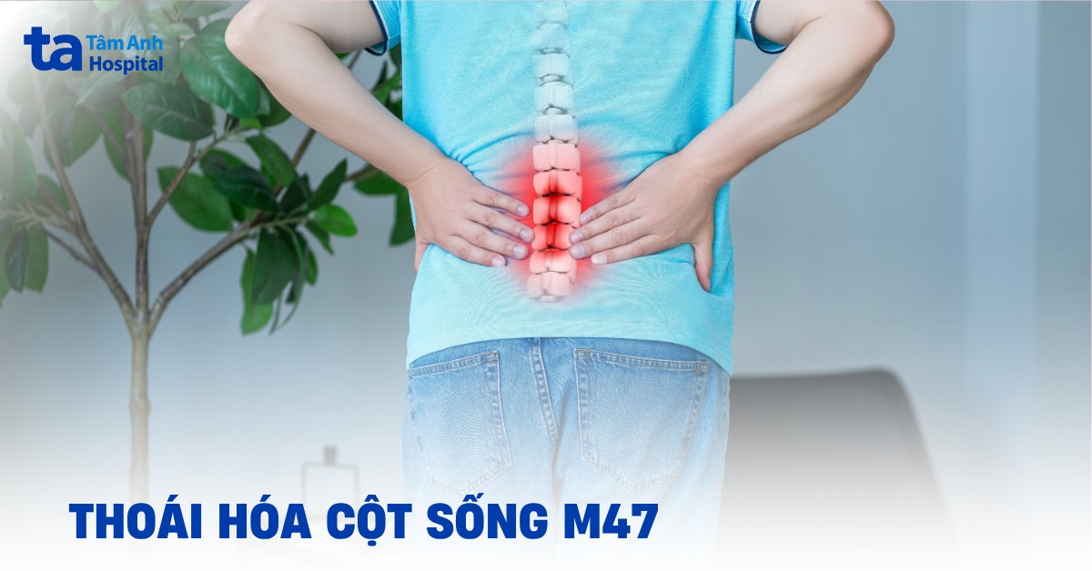 Thoai Hoa Cot Song M47
