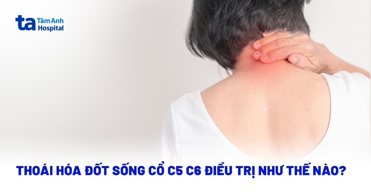 Thoai Hoa Dot Song Co C5 C6