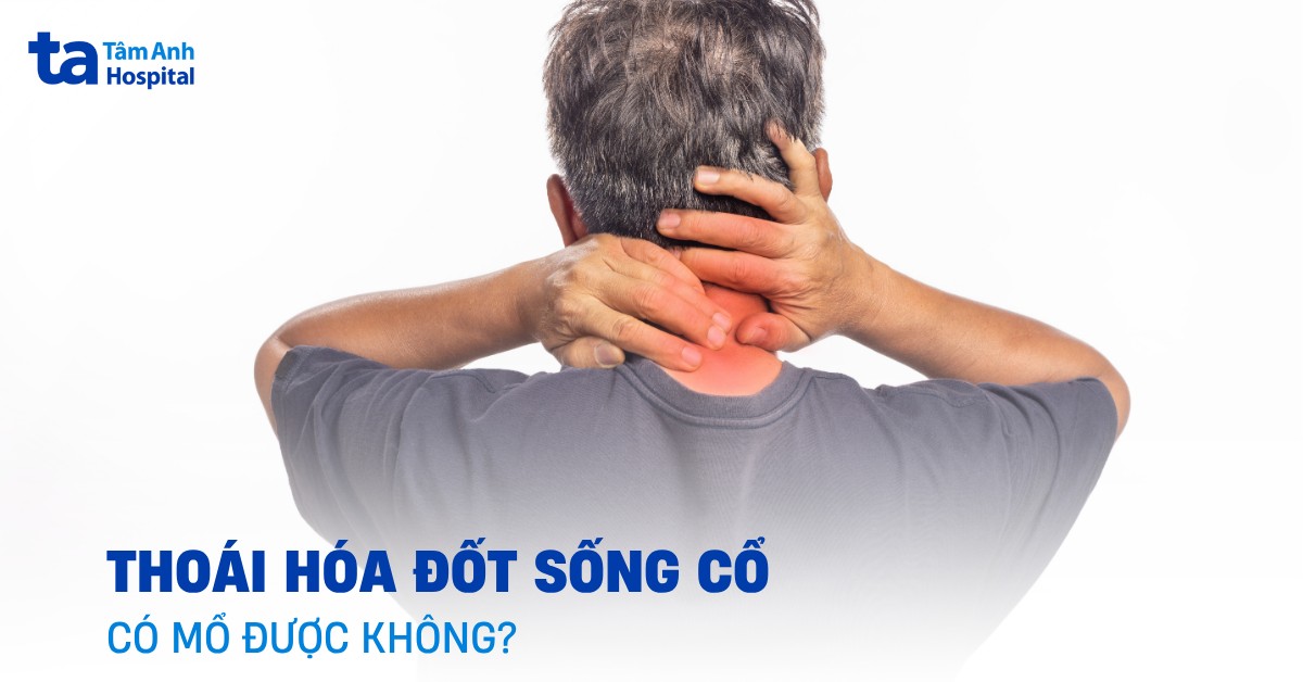 Thoai Hoa Dot Song Co Co Mo Duoc Khong