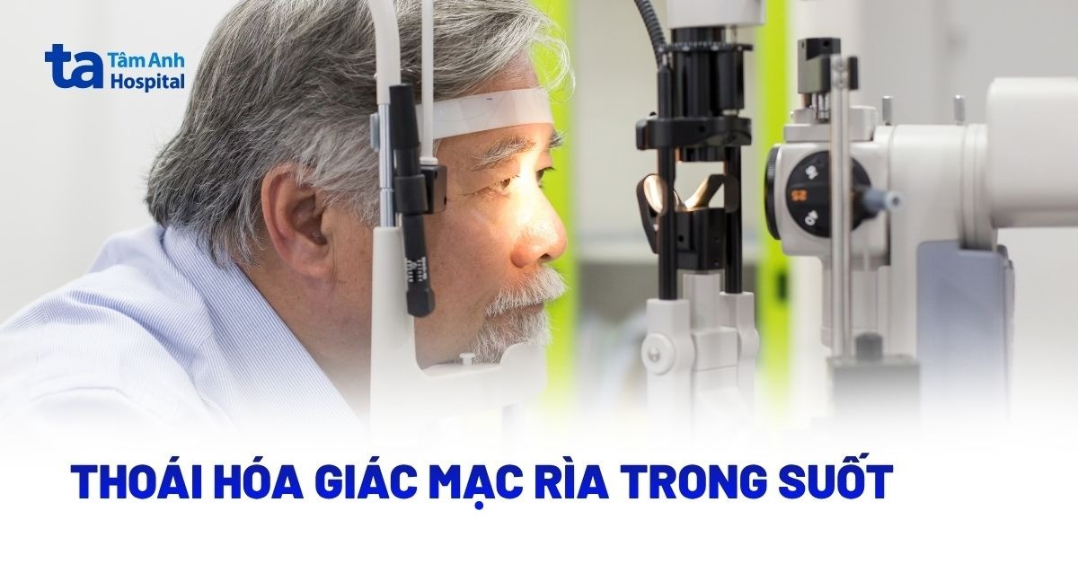 Thoai Hoa Giac Mac Ria Trong Suot