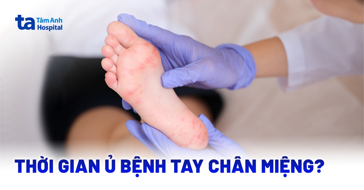 Thoi Gian U Benh Tay Chan Mieng