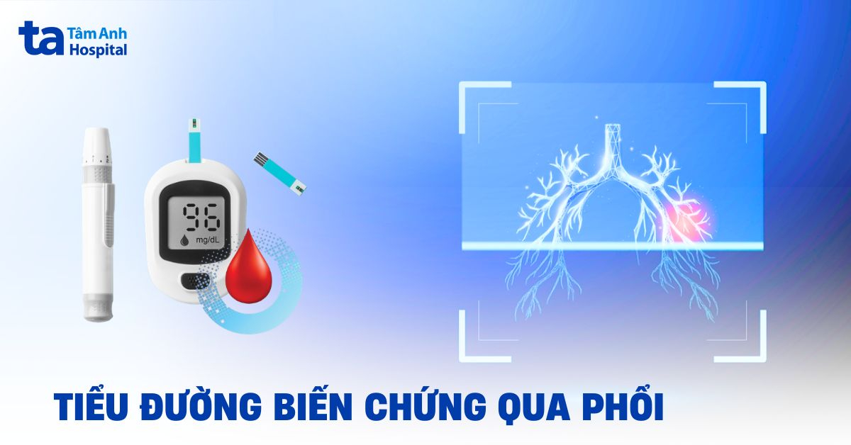 Tieu Duong Bien Chung Qua Phoi