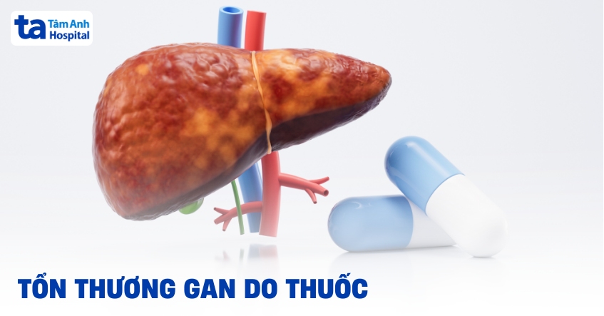 Ton Thuong Gan Do Thuoc