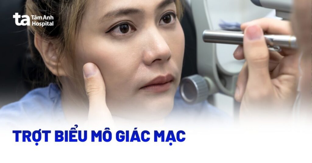 Trot Bieu Mo Giac Mac Thumb