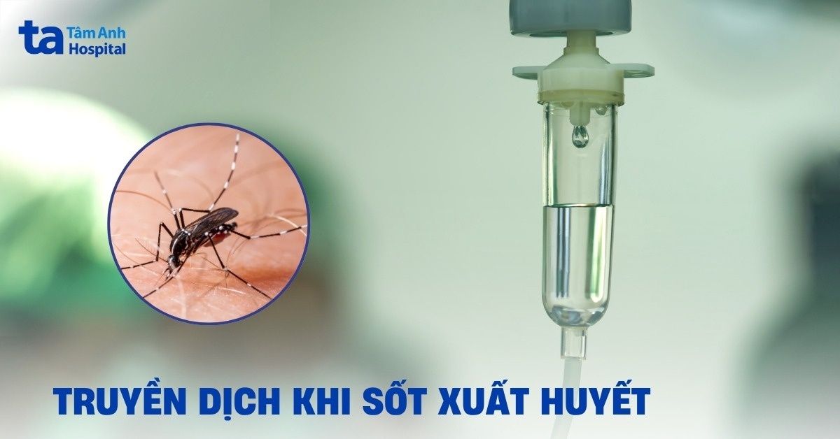 Truyen Dich Trong Sot Xuat Huyet