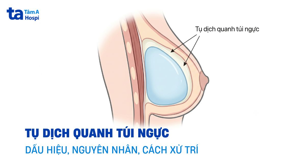 Tu Dich Quanh Tui Nguc