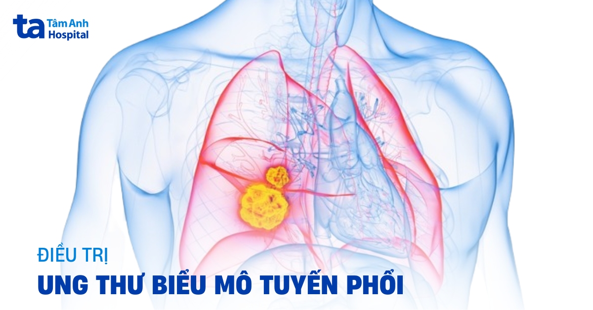 Ung Thu Bieu Mo Tuyen Phoi