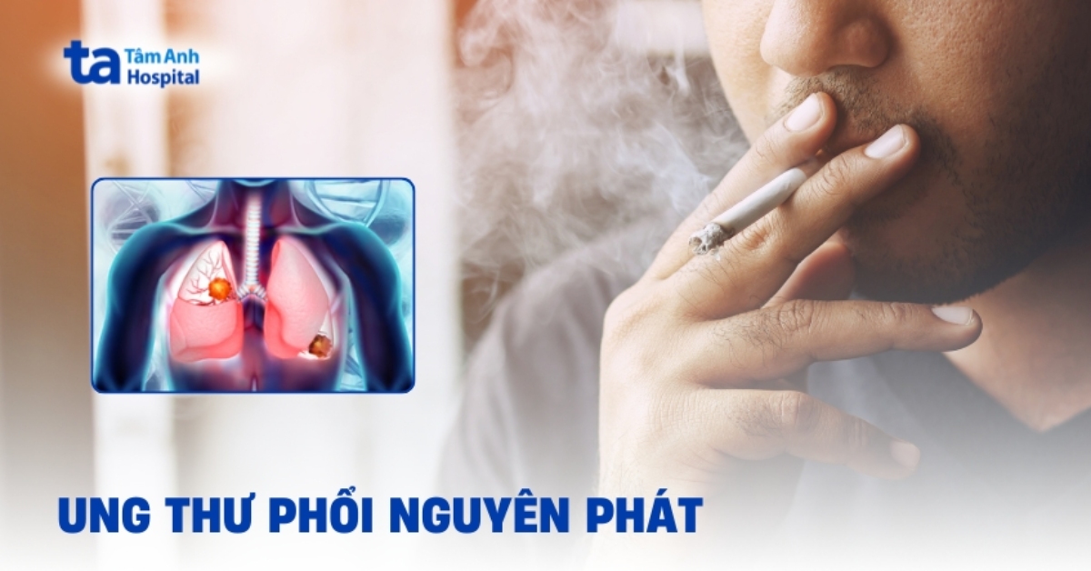 Ung Thu Phoi Nguyen Phat