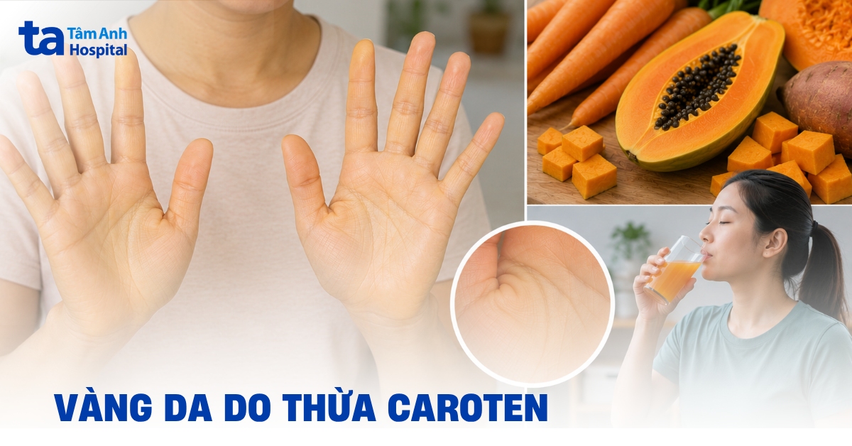 Vang Da Do Thua Caroten