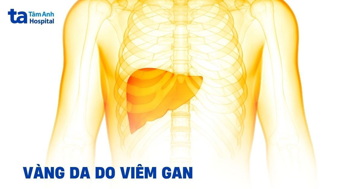 Vang Da Do Viem Gan