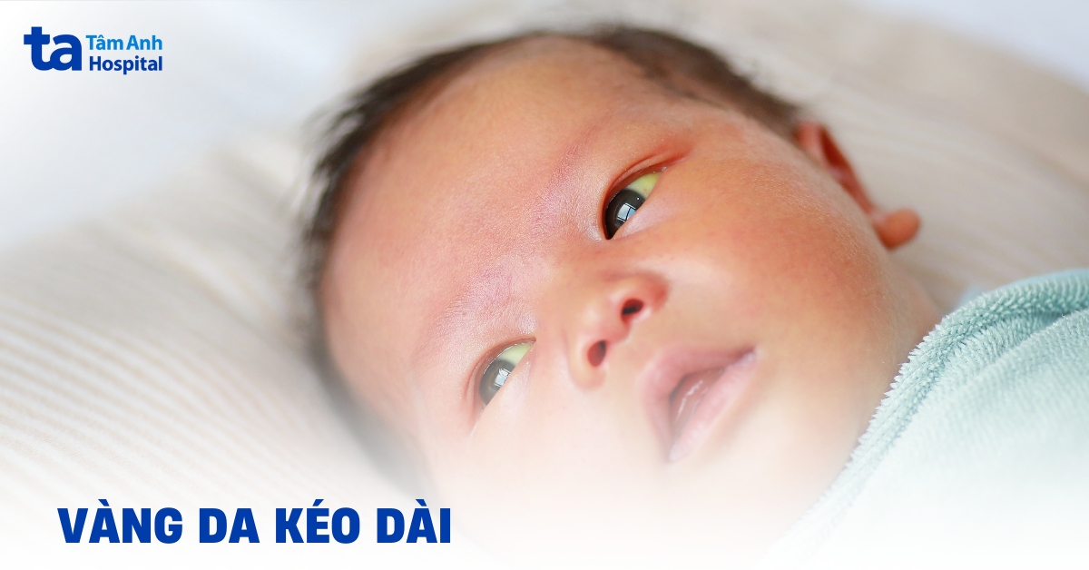 Vang Da Keo Dai