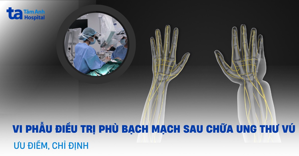 Vi Phau Dieu Tri Phu Bach Mach