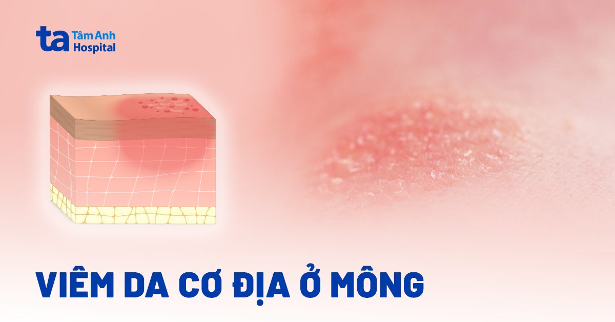Viem Da Co Dia O Mong