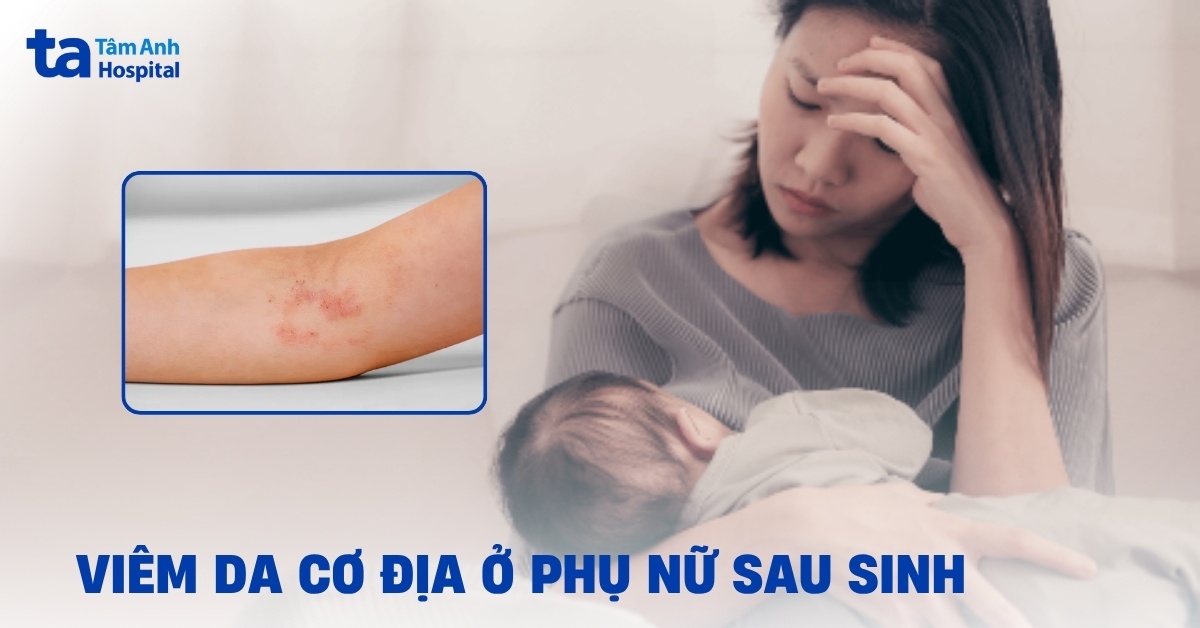 Viem Da Co Dia Sau Sinh