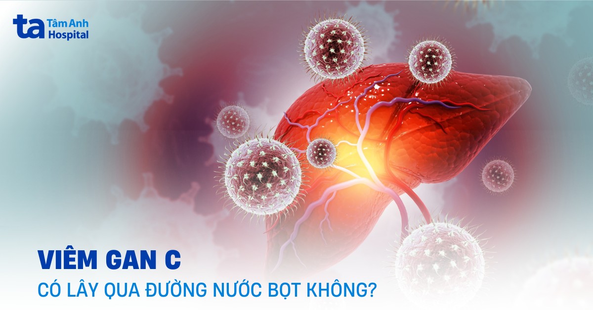 Viem Gan C Co Lay Qua Duong Nuoc Bot Khong