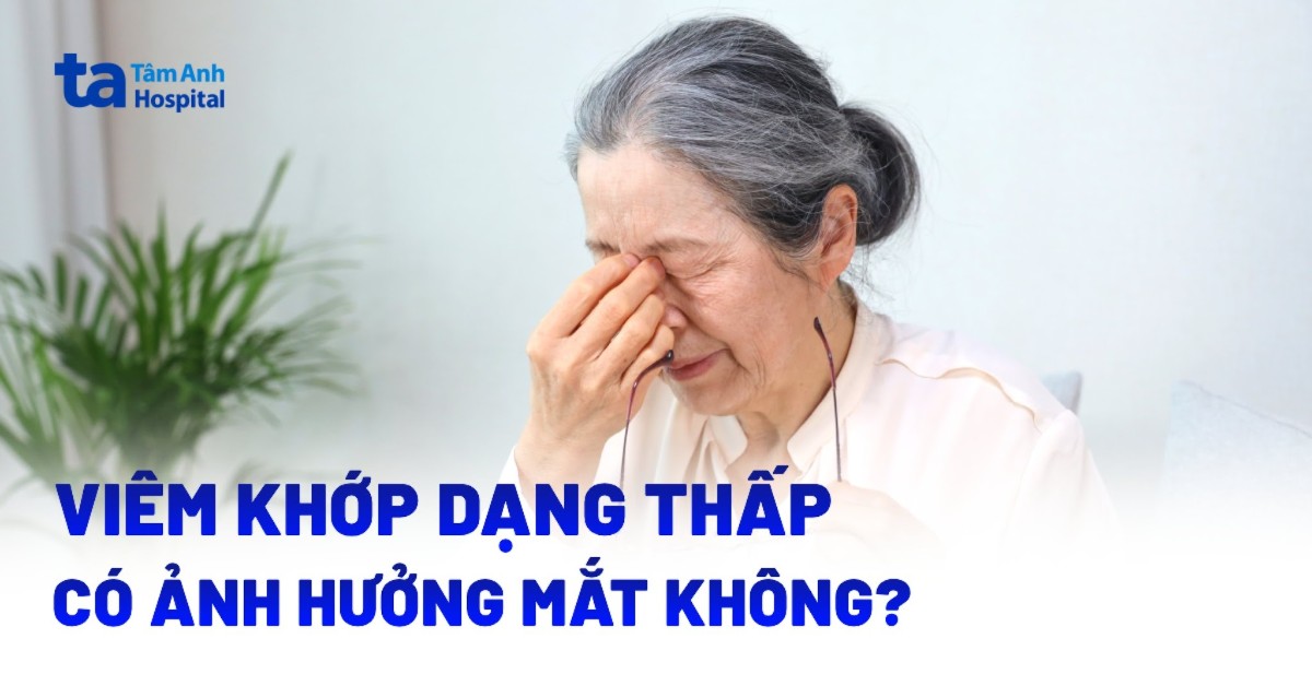Viem Khop Dang Thap Co Anh Huong Den Mat Khong