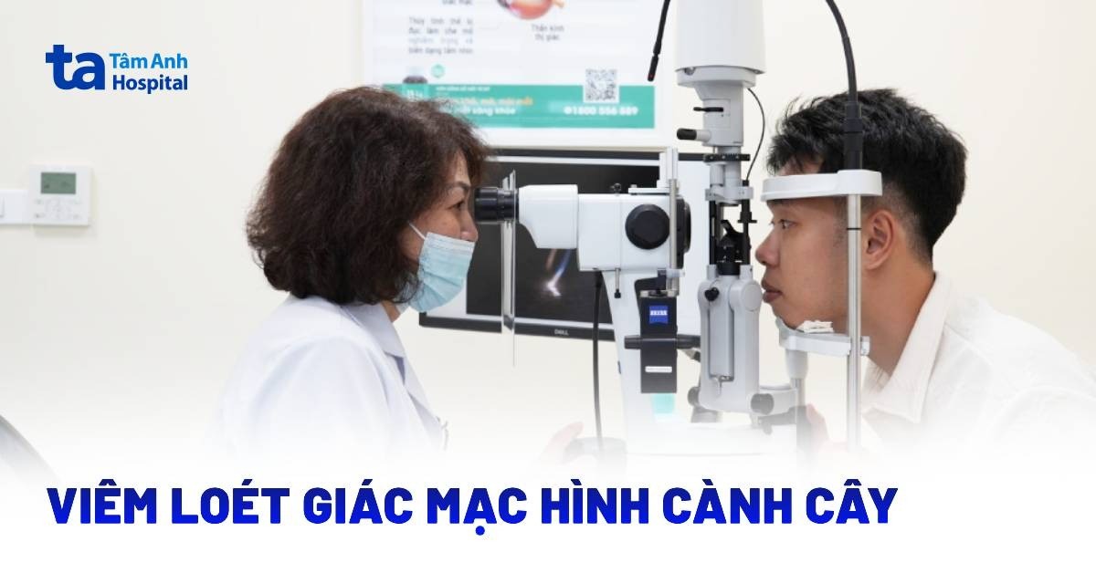 Viem Loet Giac Mac Hinh Canh Cay