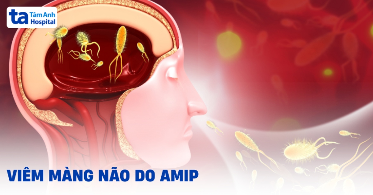 Viem Mang Nao Do Amip