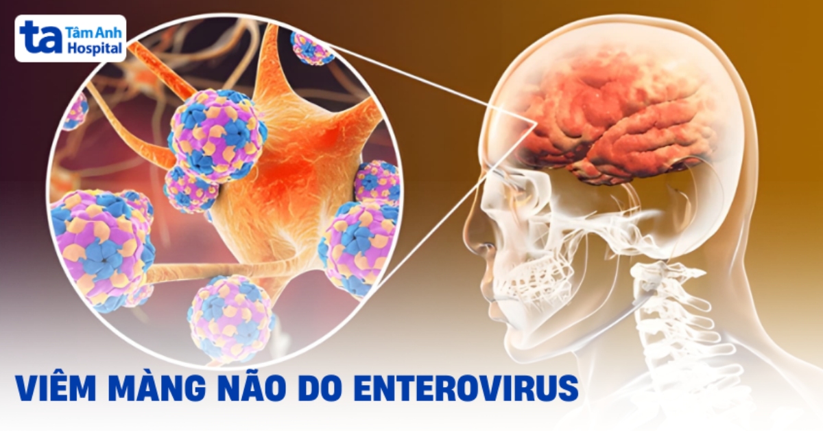 Viêm Màng Não Do Enterovirus: Các Bậc Cha Mẹ Cần Hiểu Rõ Viem Mang Nao Do Enterovirus