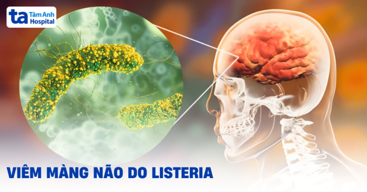 Viem Mang Nao Do Listeria