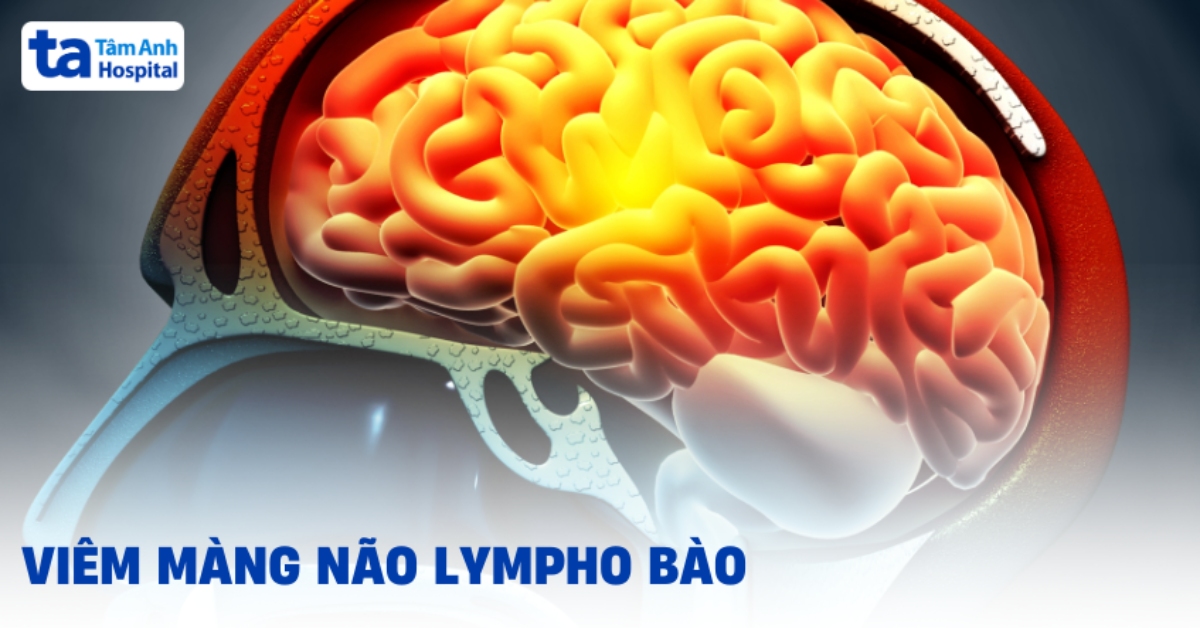 Tìm Hiểu Bệnh Viêm Màng Não Lympho Bào Viem Mang Nao Lympho Bao