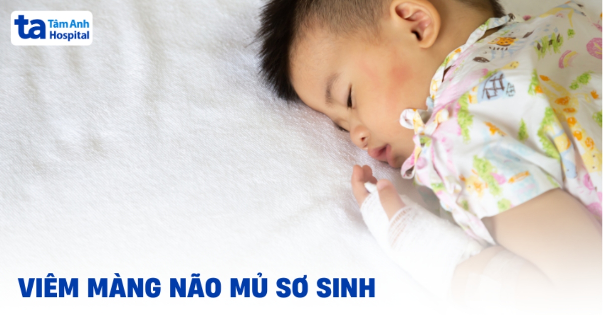 Viem Mang Nao Mu So Sinh