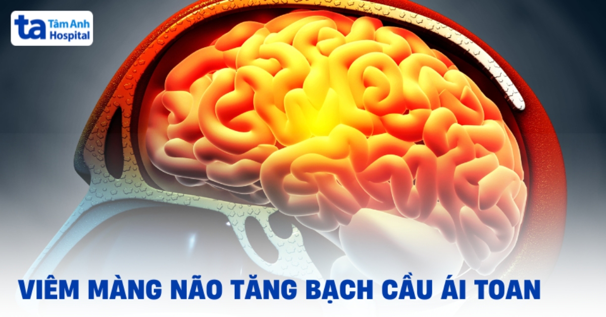 Thông Tin Cần Biết Về Viêm Màng Não Tăng Bạch Cầu Ái Toan Viem Mang Nao Tang Bach Cau Ai Toan