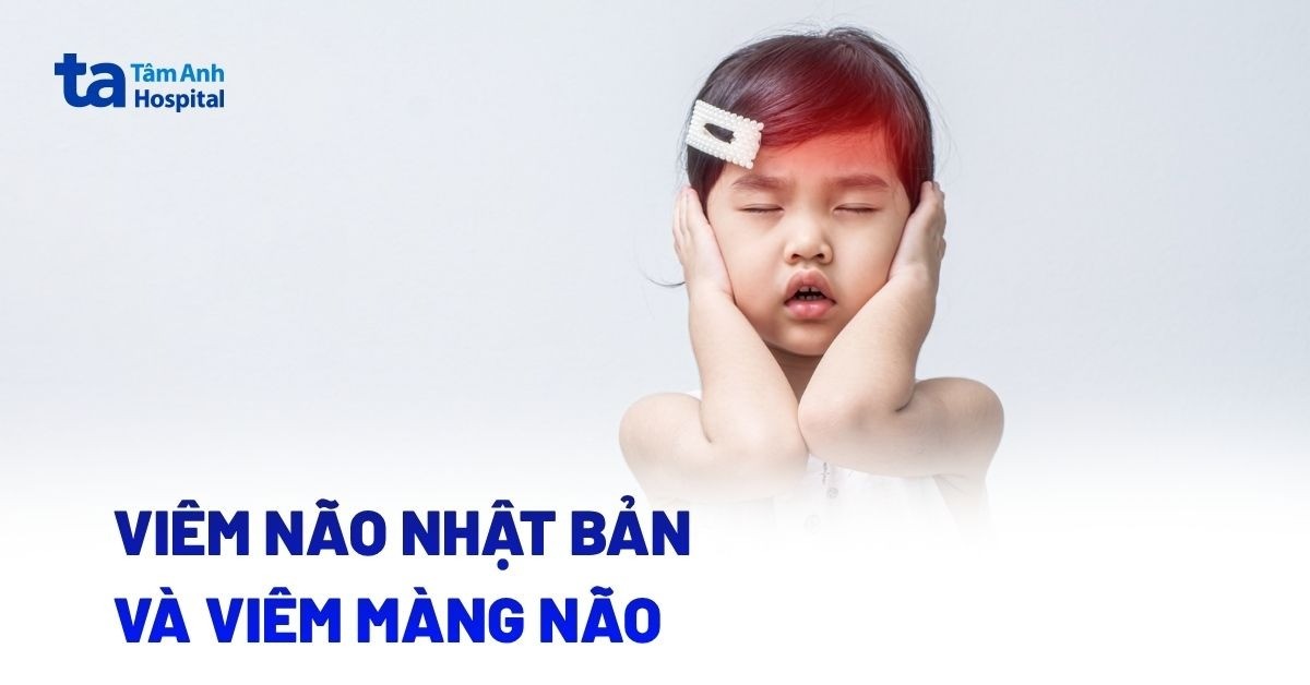 Viem Mang Nao Va Viem Nao Nhat Ban