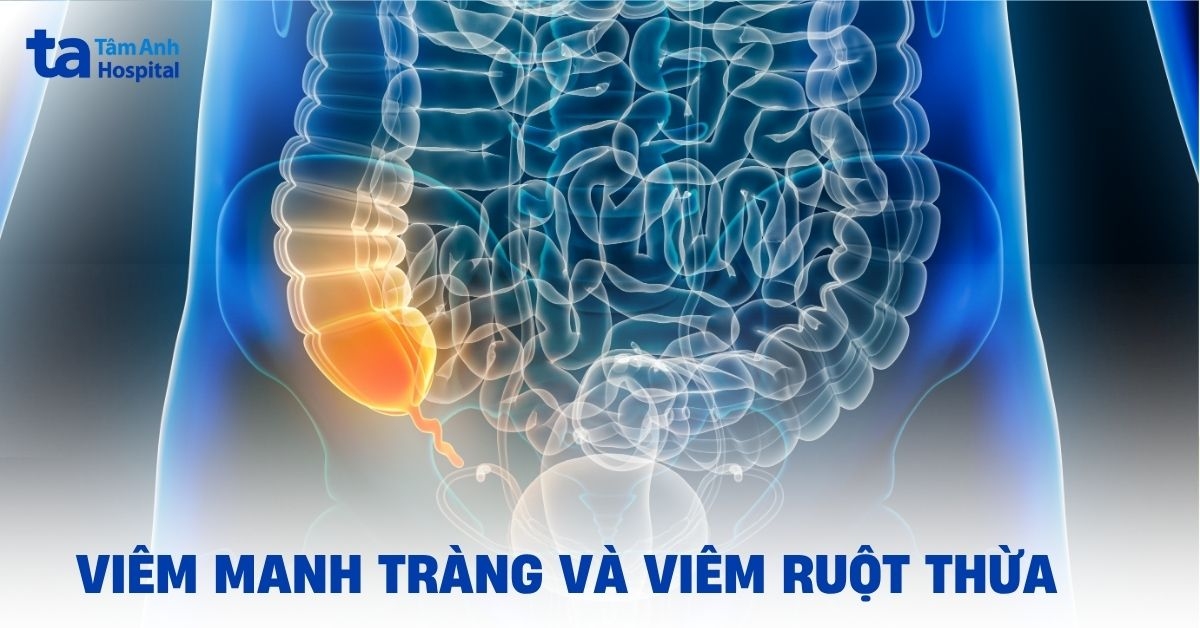 Viem Manh Trang Va Viem Ruot Thua