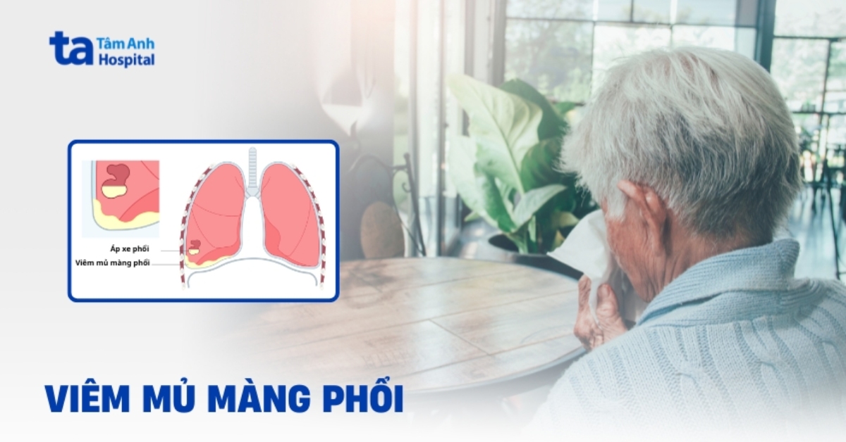 Viem Mu Mang Phoi Can Phai Xu Tri Nhu The Nao