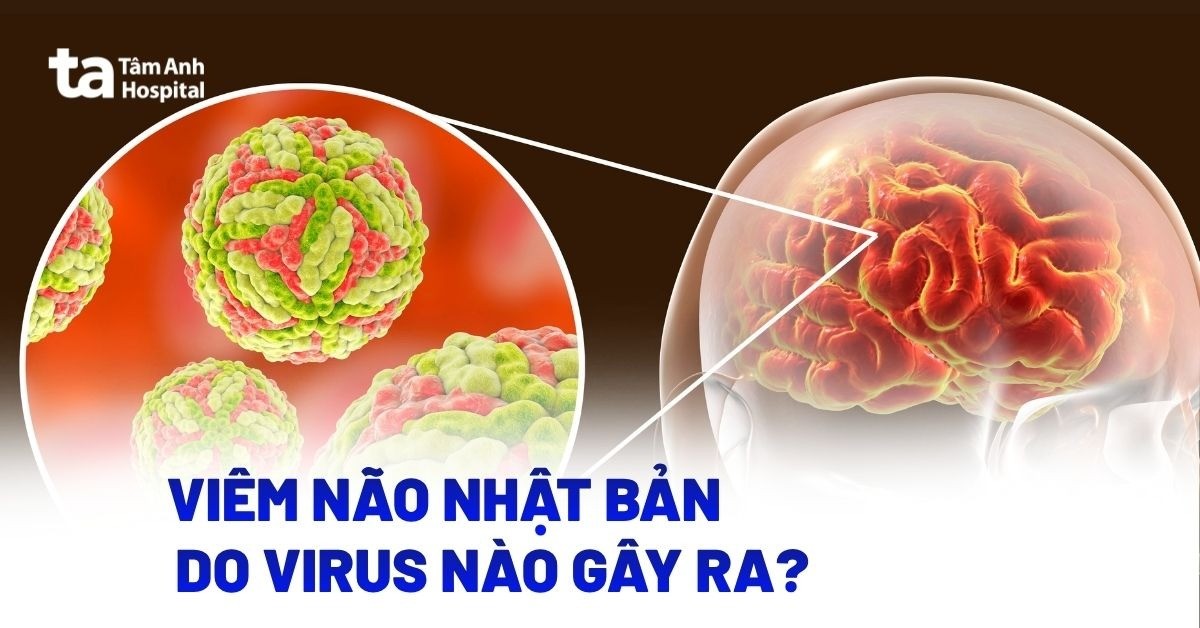 Viem Nao Nhat Ban Do Virus Nao Gay Ra