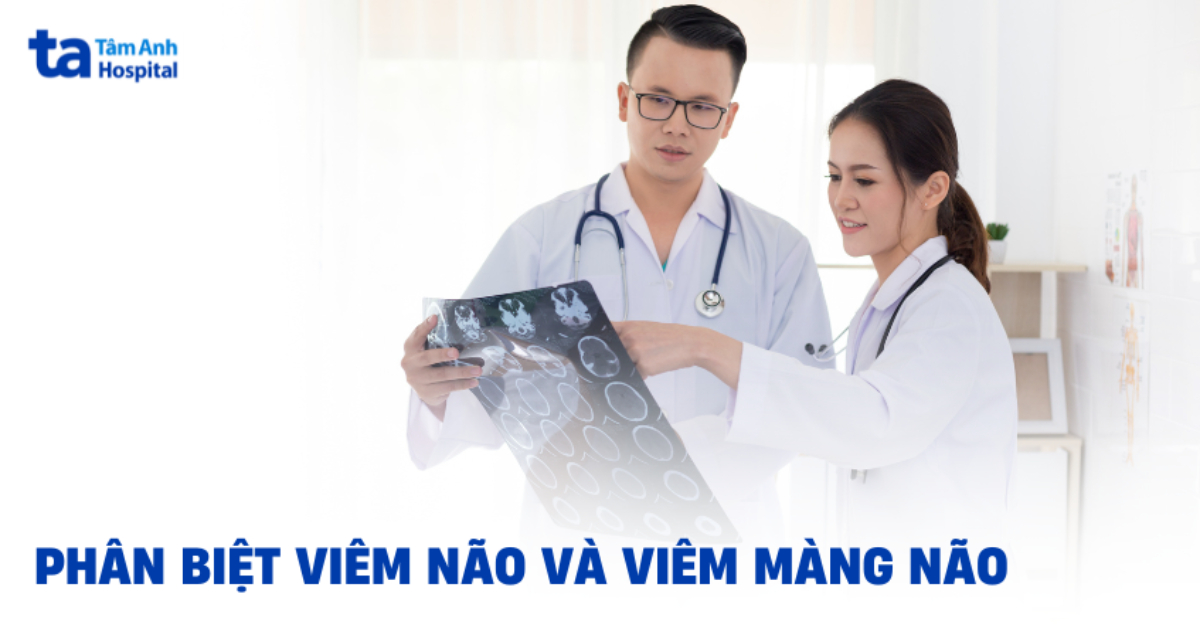 Viem Nao Va Viem Mang Nao