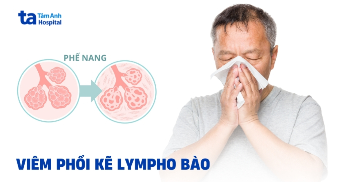 Viem Phoi Ke Lympho Bao
