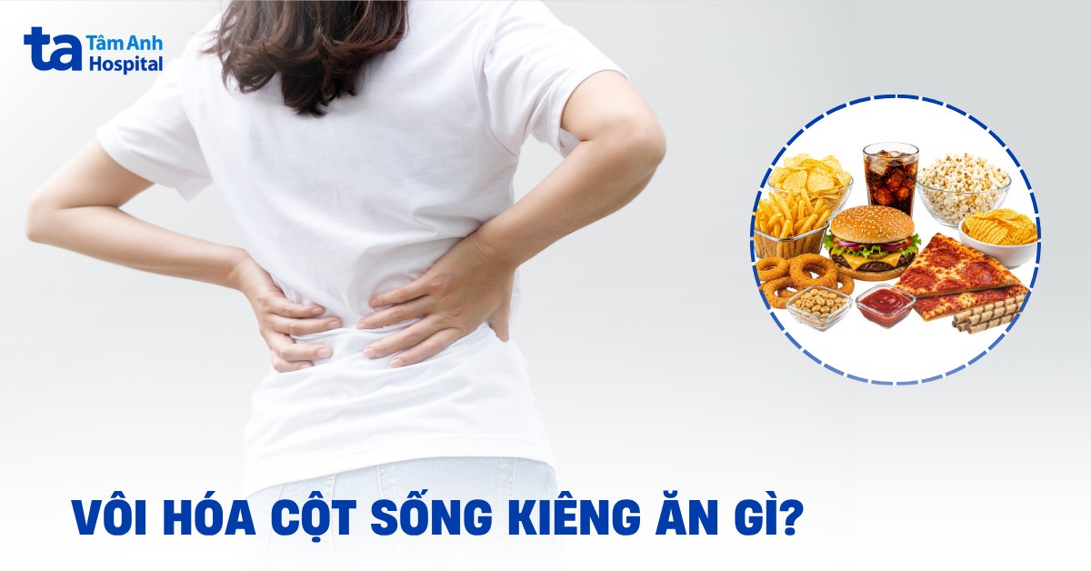 Voi Hoa Cot Song Kieng An Gi