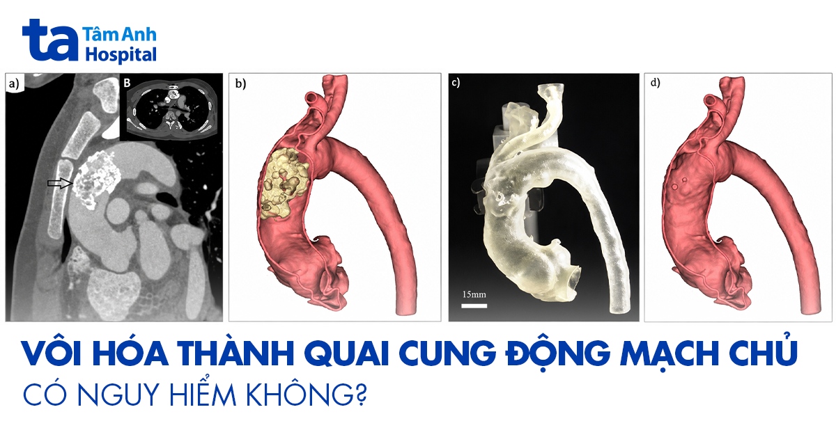 Voi Hoa Thanh Quai Cung Dong Mach Chu