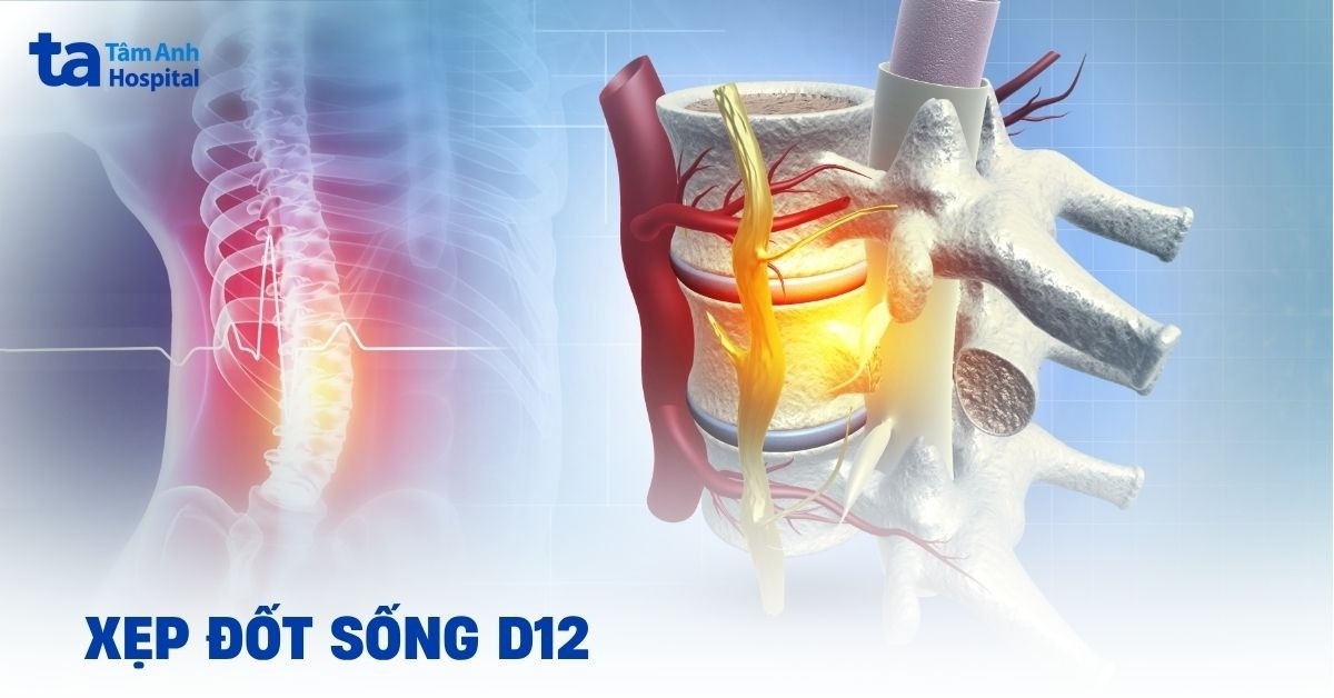 Xep Dot Song D12