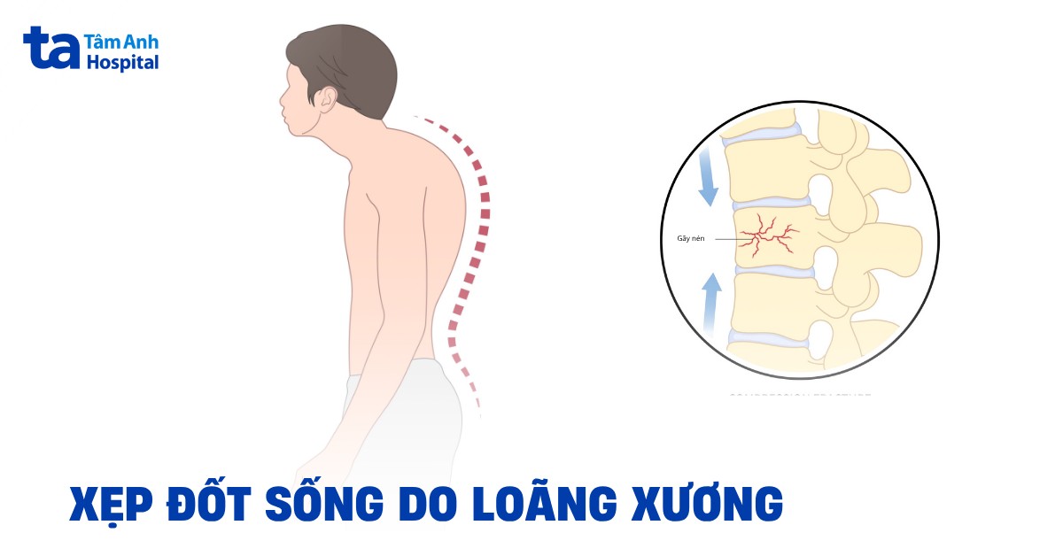 Xep Dot Song Do Loang